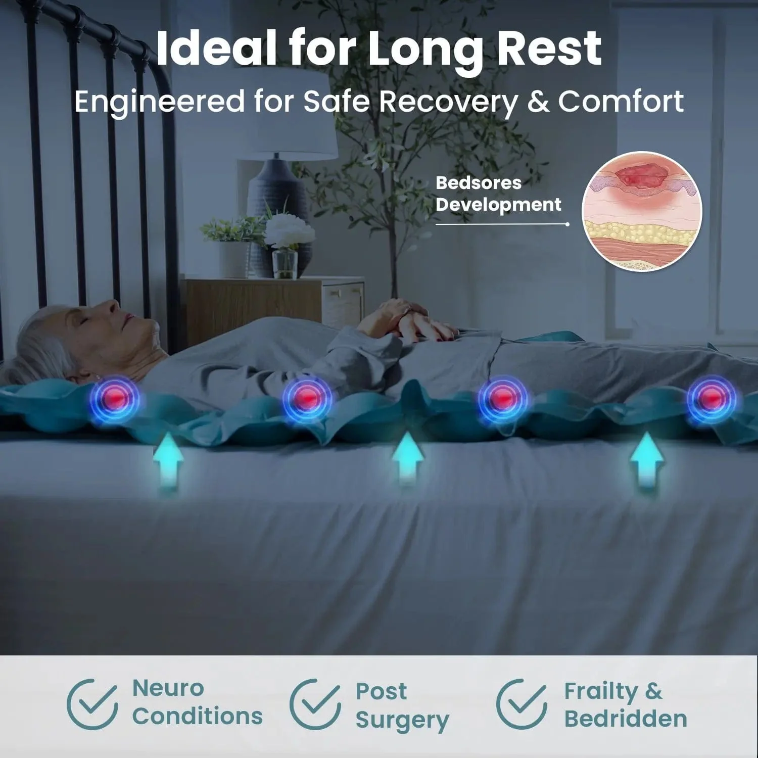 Alternating Air Pressure Mattress - Image 3